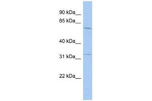 FLJ20628 antibody used at 1 ug/ml to detect target protein. (FLJ20628 (N-Term) Antikörper)