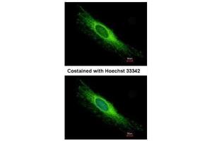 ICC/IF Image Immunofluorescence analysis of methanol-fixed HeLa, using PEX26, antibody at 1:500 dilution. (PEX26 Antikörper)