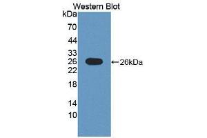 Western blot analysis of the recombinant protein. (POMT1 Antikörper  (AA 318-513))