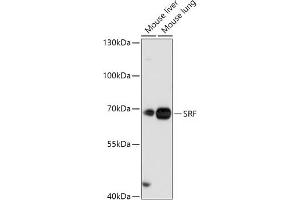 Western blot analysis of extracts of various cell lines, using SRF antibody (ABIN7270257) at 1:1000 dilution. (SRF Antikörper  (AA 1-280))