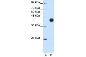 Cytokeratin 18 antibody used at 1. (Cytokeratin 18 Antikörper  (C-Term))