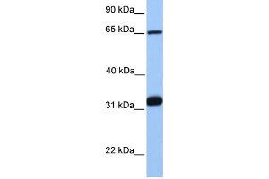 WB Suggested Anti-SF1  Antibody Titration: 0. (Splicing Factor 1 Antikörper  (C-Term))