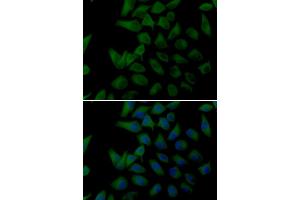 Immunofluorescence analysis of U2OS cells using PLOD2 antibody. (PLOD2 Antikörper)