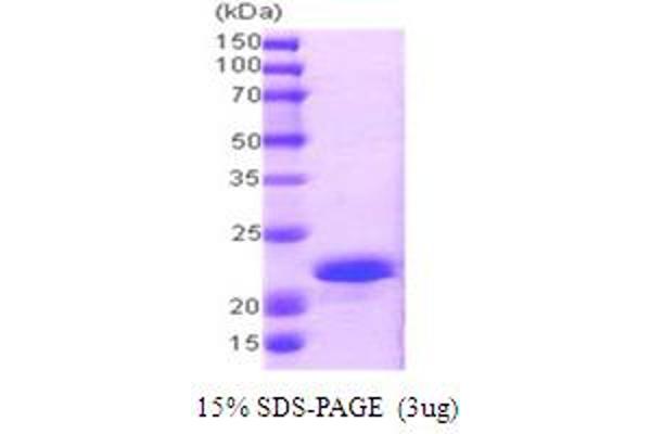 CPI-17 Protein (AA 1-147) (His tag)