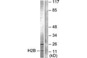 Western blot analysis of extracts from Raw264. (Histone H2B Antikörper  (acLys15))