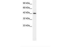 Image no. 1 for anti-Y Box Binding Protein 1 (YBX1) (AA 236-285) antibody (ABIN6735879) (YBX1 Antikörper  (AA 236-285))