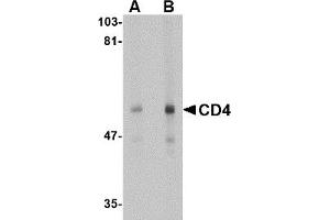 Western Blotting (WB) image for anti-CD4 (CD4) antibody (ABIN1031727) (CD4 Antikörper)