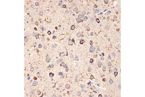 Immunohistochemistry of paraffin-embedded mouse brain using Musashi-2 (Musashi-2 (MSI2)) Rabbit mAb (ABIN7268701) at dilution of 1:100 (40x lens). (MSI2 Antikörper)
