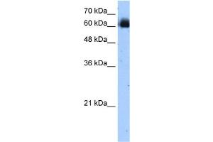 WB Suggested Anti-RELB Antibody Titration:  1. (RELB Antikörper  (C-Term))
