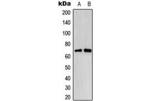 Western blot analysis of Estrogen Receptor alpha (pS118) expression in MCF7 EGF-treated (A), HeLa EGF-treated (B) whole cell lysates. (Estrogen Receptor alpha Antikörper  (pSer118))