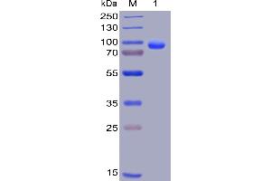 Human CD138, hFc-His Tag on SDS-PAGE under reducing condition. (Syndecan 1 Protein (SDC1) (AA 23-254) (Fc-His Tag))
