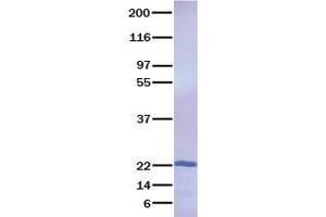 Validation with Western Blot (Resistin Protein (RETN) (Transcript Variant 1))