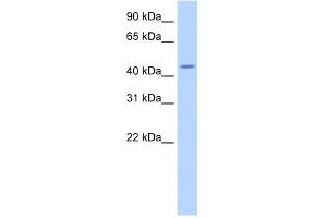 WB Suggested Anti-TRNT1 Antibody Titration:  2. (Trnt1 Antikörper  (N-Term))
