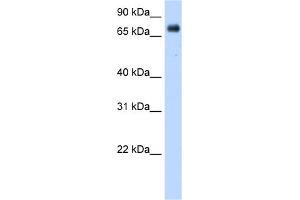 WB Suggested Anti-POR Antibody Titration:  0. (POR Antikörper  (Middle Region))