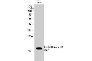 Western Blotting (WB) image for anti-Histone 3 (H3) (H3K27ac) antibody (ABIN3179370) (Histone 3 Antikörper  (H3K27ac))