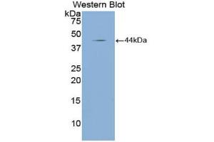 Western blot analysis of the recombinant protein. (NPPA Antikörper  (AA 25-152))