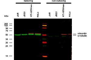 Western Blotting (WB) image for anti-Vimentin (VIM) antibody (ABIN94491)