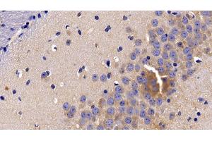Detection of TNFR1 in Mouse Cerebrum Tissue using Polyclonal Antibody to Tumor Necrosis Factor Receptor 1 (TNFR1) (TNFRSF1A Antikörper  (AA 239-433))