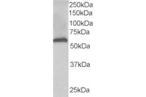 Image no. 2 for anti-Formiminotransferase Cyclodeaminase (FTCD) (N-Term) antibody (ABIN374453) (FTCD Antikörper  (N-Term))