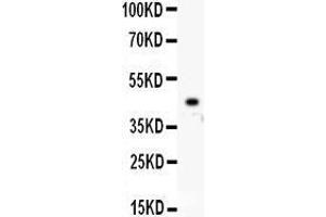 Anti- IKK beta antibody, Western blotting All lanes: Anti IKK beta  at 0. (IKBKB Antikörper  (AA 398-756))