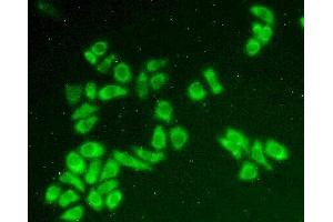 Figure:FITC staining on IHC-P Simple: Hela cells (BLVRB Antikörper  (AA 2-206))