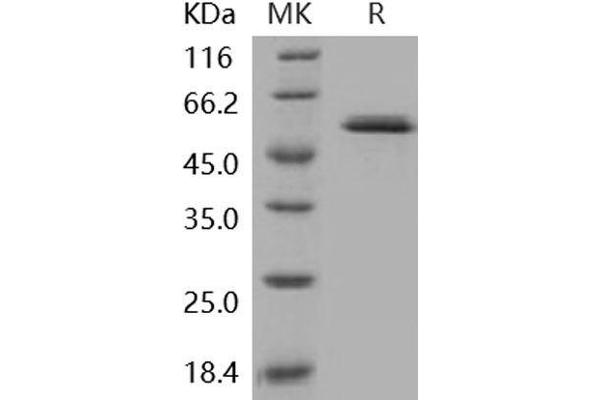 GCK Protein