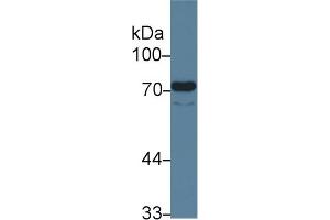 Detection of ENG in Human Lung lysate using Monoclonal Antibody to Endoglin (ENG) (Endoglin Antikörper  (AA 26-136))