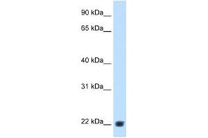 KLK-B1 antibody used at 2. (KLK-B1 Antikörper)