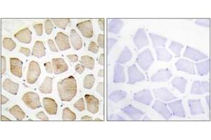 Immunohistochemistry analysis of paraffin-embedded human skeletal muscle tissue, using MAPK3 Antibody. (ERK1 Antikörper  (AA 301-350))