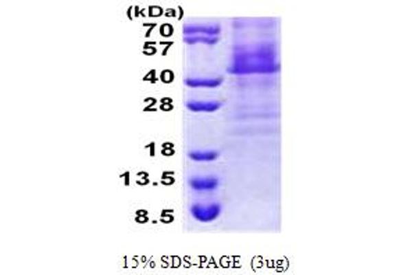 HOXC11 Protein (AA 1-304) (His tag)