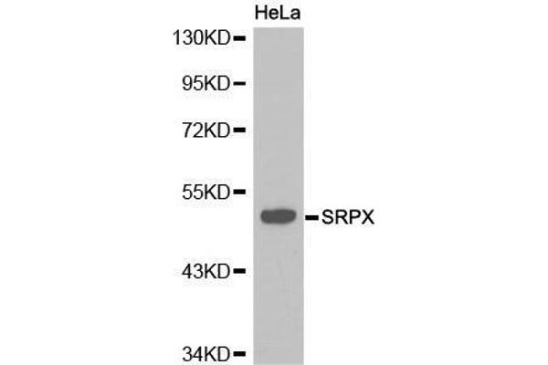 SRPX Antikörper  (AA 40-320)