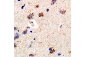 Immunohistochemical analysis of PIP4K2 beta staining in rat brain formalin fixed paraffin embedded tissue section. (PIP4K2B Antikörper)