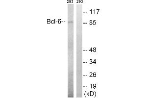 Western blot analysis of extracts from 293 cells, using Bcl-6 (Ab-333) antibody. (BCL6 Antikörper  (Ser333))