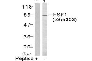 Image no. 2 for anti-Heat Shock Factor Protein 1 (HSF1) (pSer303) antibody (ABIN197024) (HSF1 Antikörper  (pSer303))