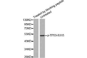 Western blot analysis of extracts from Hela cells, using Phospho-TP53-S315 antibody. (p53 Antikörper  (pSer315))