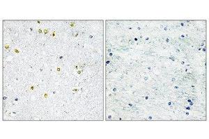 Immunohistochemistry (IHC) image for anti-Tripartite Motif Containing 24 (TRIM24) (C-Term) antibody (ABIN1848954) (TRIM24 Antikörper  (C-Term))