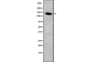 Western blot analysis FOG2 using Jurkat whole cell lysates (ZFPM2 Antikörper  (C-Term))