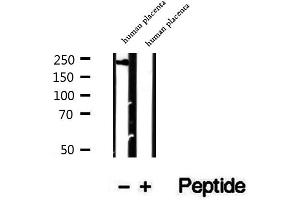 Western blot analysis of extracts of human placenta tissue, using PRPF8 antibody. (PRPF8 Antikörper  (C-Term))