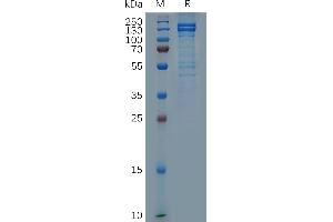 Human Protein, mFc Tag on SDS-PAGE under reducing condition. (E-cadherin Protein (AA 23-706) (mFc Tag))