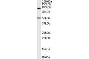 Western Blotting (WB) image for anti-Neuroligin 2 (NLGN2) (Internal Region) antibody (ABIN2466544) (Neuroligin 2 Antikörper  (Internal Region))