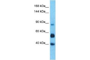 Host:  Rabbit  Target Name:  LRC66  Sample Type:  Liver Tumor lysates  Antibody Dilution:  1. (LRRC66 Antikörper  (C-Term))