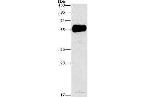 Western blot analysis of Mouse pancreas tissue, using AMY2A Polyclonal Antibody at dilution of 1:1550 (AMY2A Antikörper)