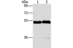 Western Blot analysis of Mouse brain and liver tissue using SPHK2 Polyclonal Antibody at dilution of 1:200 (SPHK2 Antikörper)