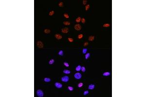 Immunofluorescence analysis of U-2 OS cells using HD Rabbit mAb (ABIN1680476, ABIN3015870, ABIN3015871 and ABIN7101453) at dilution of 1:100 (40x lens). (HDAC9 Antikörper)