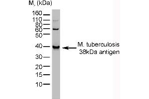 Western Blotting (WB) image for anti-Mycobacterium Tuberculosis antibody (ABIN2475767) (M. tuberculosis Antikörper)