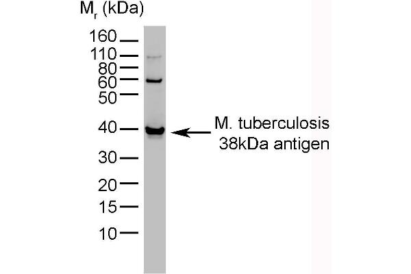 M. tuberculosis Antikörper