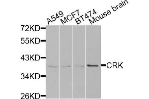 Western blot analysis of extracts of various cell lines, using CRK antibody (ABIN5975327) at 1/1000 dilution. (Crk Antikörper)