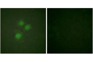 Immunofluorescence analysis of HuvEc cells, using NIFK (Ab-234) Antibody. (NIFK Antikörper  (AA 200-249))