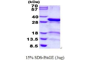 Image no. 1 for Proteasome (Prosome, Macropain) 26S Subunit, Non-ATPase, 9 (PSMD9) protein (His tag) (ABIN1098457) (PSMD9 Protein (His tag))