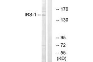 Western blot analysis of extracts from NIH-3T3 cells, using IRS-1 (Ab-312) Antibody. (IRS1 Antikörper  (AA 279-328))